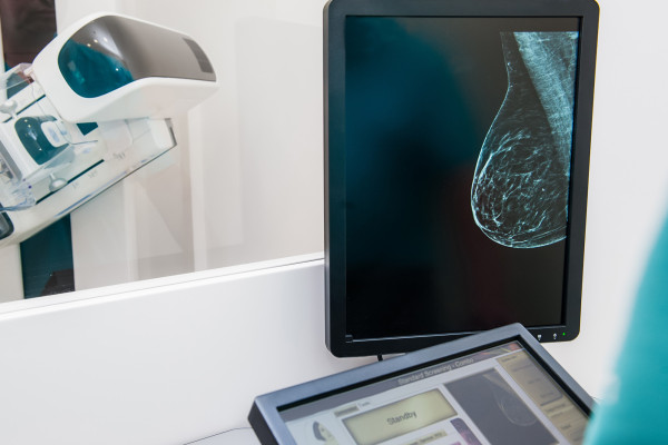 研究发现，谷歌人工智能比医生更能发现乳腺癌
