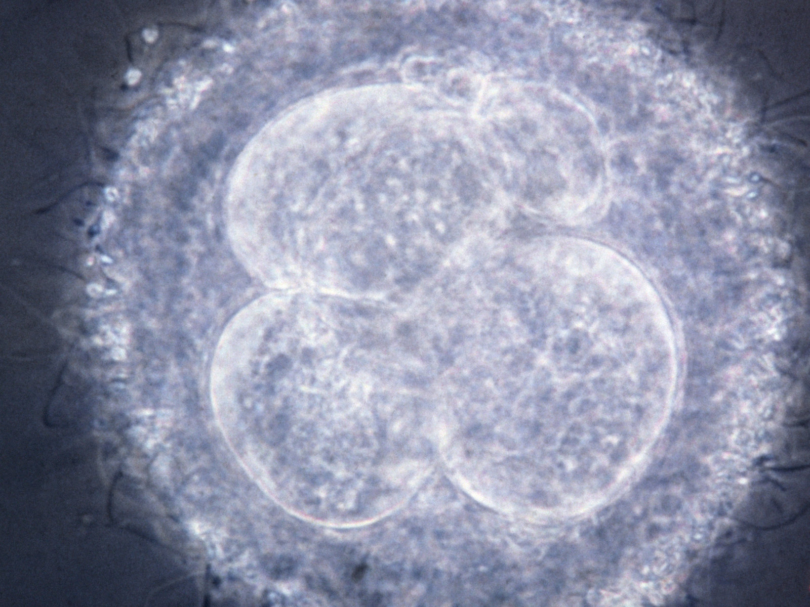 胚胎研究以减少对体外受精的需要引起了伦理上的关注