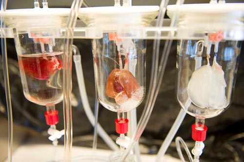 科学家用病人自身细胞订做器官