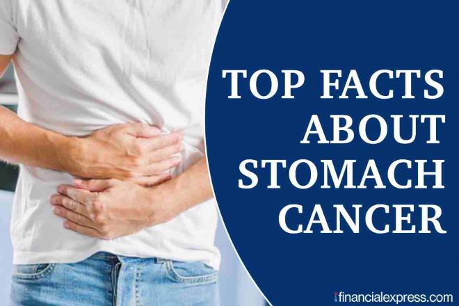 胃灼热和胃酸倒流药物使胃癌的风险增加一倍